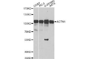 Western blot analysis of extracts of various cell lines, using ACTN1 antibody.