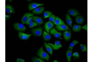 Immunofluorescence staining of A549 cells with ABIN7168014 at 1:66, counter-stained with DAPI. (RND1 anticorps  (AA 1-106))