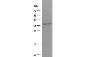 Western Blotting (WB) image for Solute Carrier Family 1 (Glial High Affinity Glutamate Transporter), Member 2 (SLC1A2) (AA 143-240) protein (His-IF2DI Tag) (ABIN7125152)
