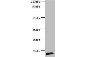 Western blot All lanes: TNNC2 antibody at 10 μg/mL + Mouse skeletal muscle tissue Secondary Goat polyclonal to rabbit IgG at 1/10000 dilution Predicted band size: 18 kDa Observed band size: 18 kDa (TNNC2 anticorps  (AA 1-160))