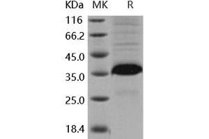Western Blotting (WB) image for Follistatin-Like 3 (Secreted Glycoprotein) (FSTL3) (Active) protein (His tag) (ABIN7320428) (FSTL3 Protein (His tag))