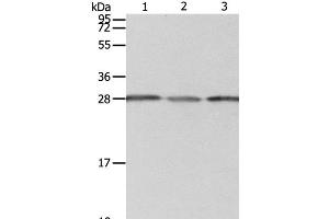 Western Blot analysis of A549 cell, Human liver cancer and fetal kidney tissue using PSMD9 Polyclonal Antibody at dilution of 1:800