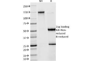 SDS-PAGE Analysis Purified Creatine Kinase-BB (CKBB) Mouse Monoclonal Antibody (2ba6). (CKB anticorps)