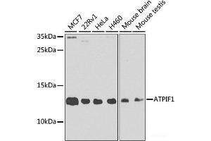 Western blot analysis of extracts of various cell lines using ATPIF1 Polyclonal Antibody at dilution of 1:1000.