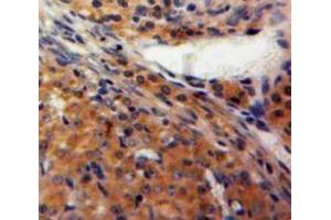 IHC-P analysis of Ovary tissue, with DAB staining. (FBLN2 anticorps  (AA 858-1069))