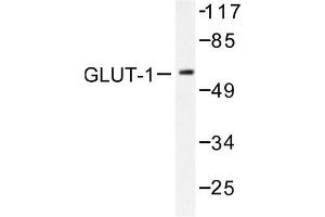 Image no. 1 for anti-Solute Carrier Family 2 (Facilitated Glucose Transporter), Member 1 (SLC2A1) antibody (ABIN265442) (GLUT1 anticorps)