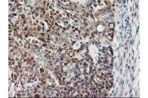 Image no. 2 for anti-Calpain 9 (CAPN9) antibody (ABIN1497092) (Calpain 9 anticorps)