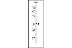 Western blot analysis of CTDSPL Antibody (N-term) in Hela cell line lysates (35ug/lane). (CTDSPL anticorps  (N-Term))