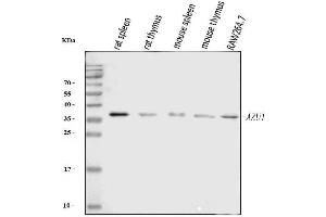 Western blot analysis of Azurocidin/AZU1 using anti-Azurocidin/AZU1 antibody (ABIN7601000).