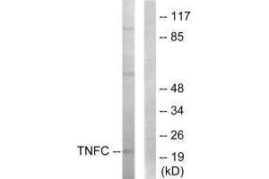 Western blot analysis of extracts from HepG2 cells, using TNFC antibody. (LTB anticorps  (C-Term))