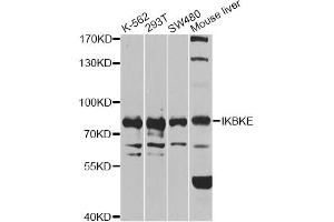 Western blot analysis of extracts of various cell lines, using IKBKE antibody (ABIN6292135) at 1:1000 dilution.