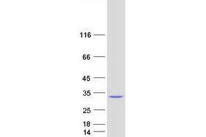 Validation with Western Blot
