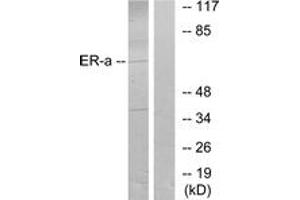 Western blot analysis of extracts from MCF7 cells, treated with Estradiol, using Estrogen Receptor-alpha (Ab-106) Antibody. (Estrogen Receptor alpha anticorps  (AA 71-120))