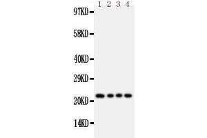 Anti-FGF22 antibody, Western blotting Lane 1: Rat Ovary Tissue Lysate Lane 2: Rat Ovary Tissue Lysate Lane 3: Rat Testis Tissue Lysate Lane 4: Rat Testis Tissue Lysate (FGF22 anticorps  (Middle Region))