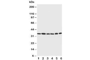 Western blot testing of Cdk4 antibody and Lane 1:  rat thymus (CDK4 anticorps  (C-Term))