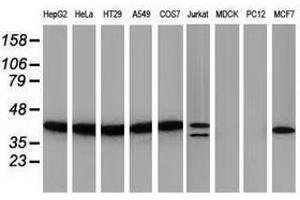 Image no. 2 for anti-PIH1 Domain Containing 2 (PIH1D2) antibody (ABIN1500197)