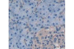 IHC-P analysis of Human Tissue, with DAB staining. (FLRT3 anticorps  (AA 29-152))