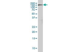 RICTOR monoclonal antibody (M01), clone 1F3 Western Blot analysis of RICTOR expression in Hela S3 NE .