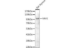 Western blot analysis of extracts of Rat thymus, using V antibody (ABIN7271302) at 1:1000 dilution.