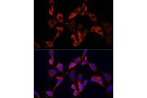 Immunofluorescence analysis of NIH/3T3 cells using DVL2 antibody (ABIN6130335, ABIN6139881, ABIN6139883 and ABIN6223455) at dilution of 1:100. (DVL2 anticorps  (AA 1-340))