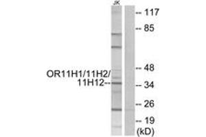 anti-Olfactory Receptor 11H1/11H2/11H12 (AA 277-326) antibody