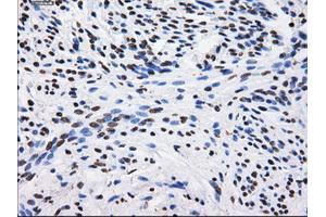 Immunohistochemical staining of paraffin-embedded Kidney tissue using anti-BTN3A2 mouse monoclonal antibody. (BTN3A2 anticorps)