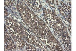 Image no. 5 for anti-Polymerase (RNA) III (DNA Directed) Polypeptide C (62kD) (POLR3C) antibody (ABIN1500340)