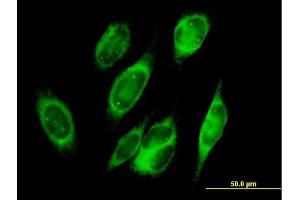 Immunofluorescence of purified MaxPab antibody to PRDX4 on HeLa cell. (Peroxiredoxin 4 anticorps  (AA 1-271))