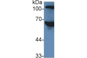 Rabbit Capture antibody from the kit in WB with Positive Control: Human serum. (SERPINC1 Kit ELISA)