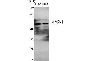 Western Blot analysis of various cells using MMP-1 Polyclonal Antibody diluted at 1:1000. (MMP1 anticorps  (AA 380-460))