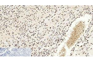Immunohistochemistry of paraffin-embedded Human appendix tissue using Acetyl-Histone H3 (Lys9) Polyclonal Antibody at dilution of 1:200. (Histone 3 anticorps  (acLys9))