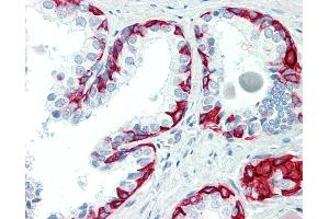Anti-ACTRIIB / ACVR2B antibody IHC staining of human prostate.