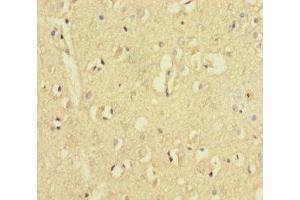 Immunohistochemistry of paraffin-embedded human brain tissue using ABIN7176535 at dilution of 1:100 (ZNF800 anticorps  (AA 1-300))