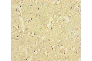Immunohistochemistry of paraffin-embedded human brain tissue using ABIN7176535 at dilution of 1:100 (ZNF8 anticorps  (AA 1-300))
