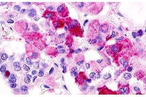 Image no. 1 for anti-G Protein-Coupled Receptor 12 (GPR12) (C-Term) antibody (ABIN1048702) (G Protein-Coupled Receptor 12 anticorps  (C-Term))