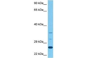Host:  Rabbit  Target Name:  STEAP1  Sample Tissue:  Human Stomach Tumor  Antibody Dilution:  1ug/ml (STEAP1B anticorps  (N-Term))