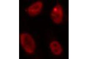 ABIN6274260 staining HepG2 cells by IF/ICC. (ID4 anticorps  (N-Term))