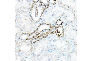 Immunohistochemistry of paraffin-embedded mouse kidney using BC Rabbit pAb (ABIN6131008, ABIN6137483, ABIN6137484 and ABIN6223295) at dilution of 1:100 (40x lens).