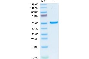 Human PLA2G1B on Tris-Bis PAGE under reduced condition. (PLA2G1B Protein (AA 23-148) (Fc Tag))