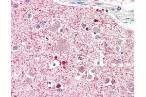 Anti-DGKQ antibody IHC staining of human brain, cortex. (DGKQ anticorps  (AA 295-298))