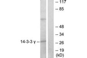 Western blot analysis of extracts from K562 cells, treated with insulin 0. (14-3-3 gamma anticorps  (AA 51-100))