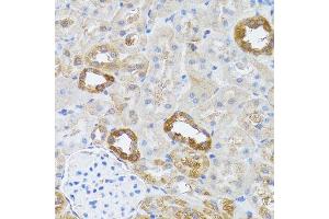 Immunohistochemistry of paraffin-embedded rat kidney using RNASEL antibody.