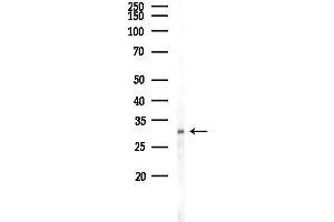 anti-Major Histocompatibility Complex, Class II, DM beta (HLA-DMB) (C-Term) antibody