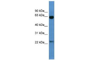 WB Suggested Anti-Baiap2 Antibody Titration:  0.