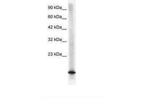 Image no. 1 for anti-Cyclin-Dependent Kinase Inhibitor 2B (p15, Inhibits CDK4) (CDKN2B) (C-Term) antibody (ABIN6735853) (CDKN2B anticorps  (C-Term))