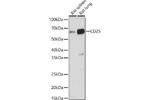 Western blot analysis of extracts of various cell lines, using CD25 antibody (ABIN3017118, ABIN3017119, ABIN3017120 and ABIN6219963) at 1:1000 dilution. (CD25 anticorps)