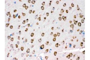 IHC analysis of TRPM5 using anti-TRPM5 antibody (ABIN3044566).