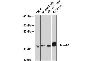 Western blot analysis of extracts of various cell lines using NAA20 Polyclonal Antibody at dilution of 1:1000. (NAT5 anticorps)