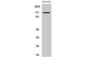 Western Blotting (WB) image for anti-Tripartite Motif Containing 24 (TRIM24) (C-Term) antibody (ABIN3177722) (TRIM24 anticorps  (C-Term))