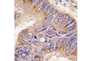 Image no. 1 for anti-Ribosomal Protein S6 (RPS6) (N-Term) antibody (ABIN357338)